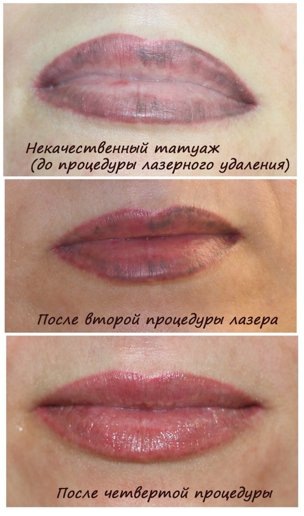 Как проявляется перманент на губах по дням фото