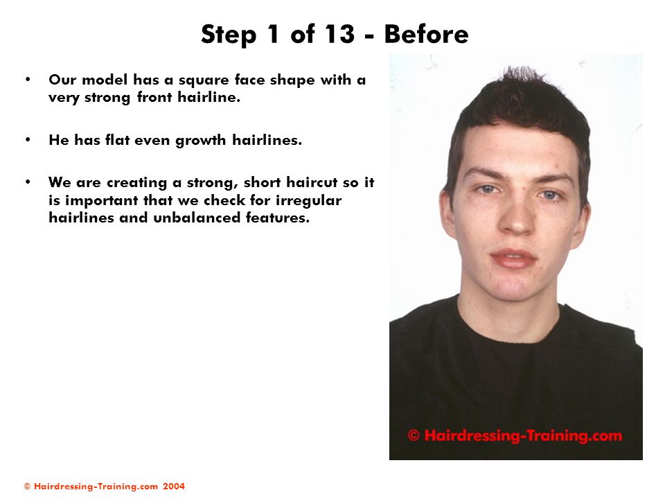 Step 1 of 13 - Before Our model has a square face shape with a very strong front hairline. He has flat even growth hairlines.