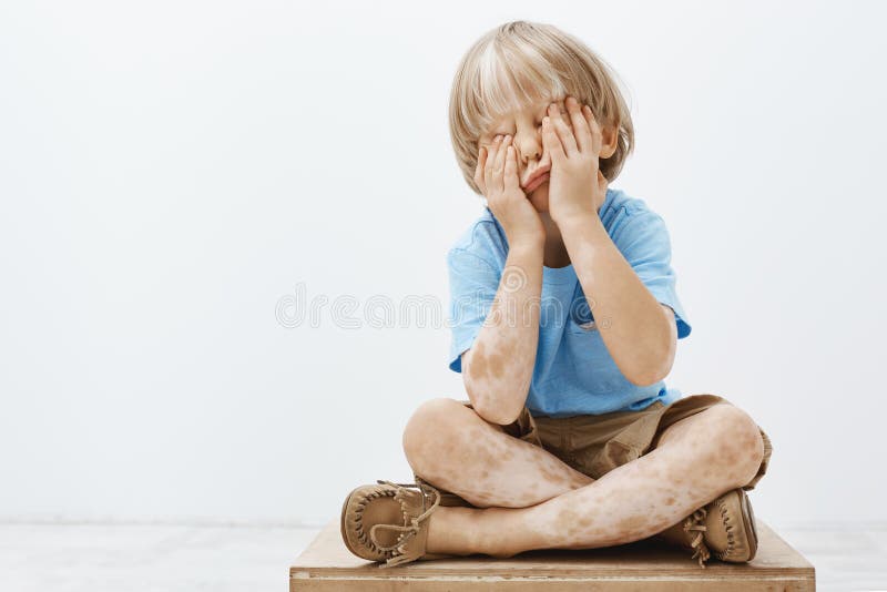 Indoor shot of cute european child with lovely haircut and vitiligo, covering face with palms while sitting, playing. Hide and seek with older brother, having royalty free stock photos