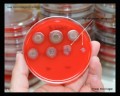 pseudomonas aeruginosa on blood agar plate