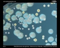 pseudomonas aeruginosa, enterococcus, golden staph